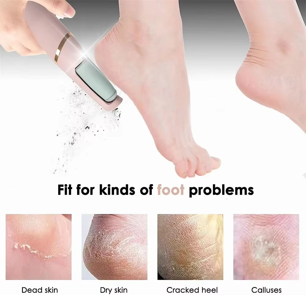 Rechargeable Electric Foot Callus Remover – Pedicure Roller Grinder