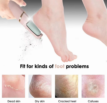 Rechargeable Electric Foot Callus Remover – Pedicure Roller Grinder
