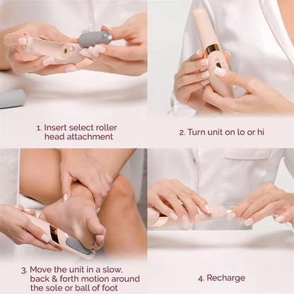 Rechargeable Electric Foot Callus Remover – Pedicure Roller Grinder