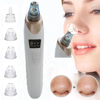 Multifunctional Blackhead Remover Vacuum – Electric Facial Pore Cleaner
